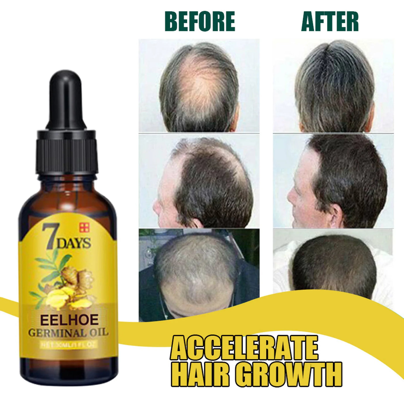 Hair Growth Serum Oil 10/20/40Ml Dense Regrowth Ginger Hair Care Repair Liquid Essential anti Loss Hair Products