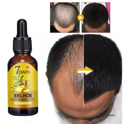 Hair Growth Serum Oil 10/20/40Ml Dense Regrowth Ginger Hair Care Repair Liquid Essential anti Loss Hair Products